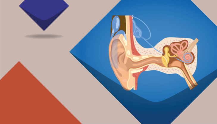 Graifk einer Cochlea Implantates im menschlichen Kopf