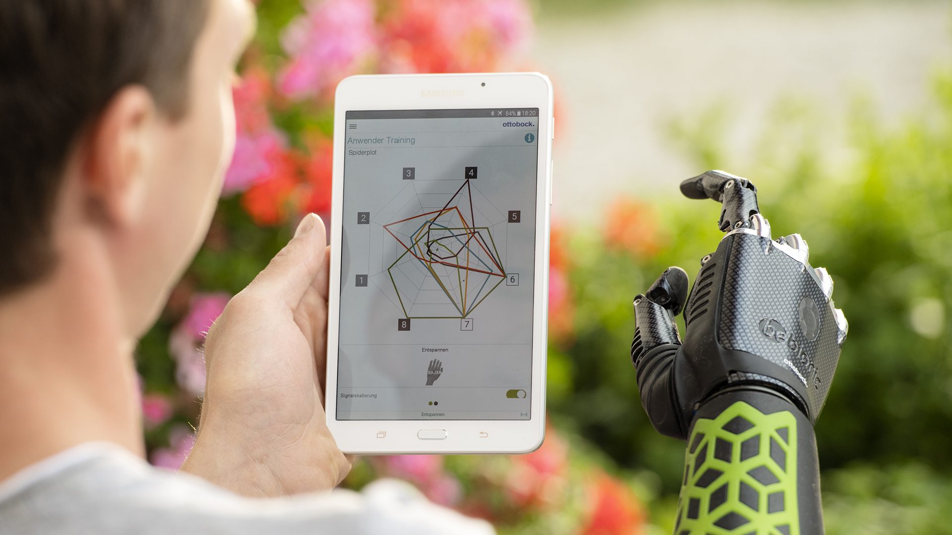 Nutzer mit Smartphone und einer Handprothese